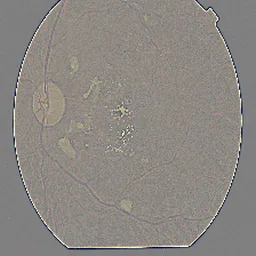 Proliferar DR
