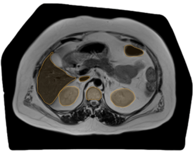 DICOM Annotation