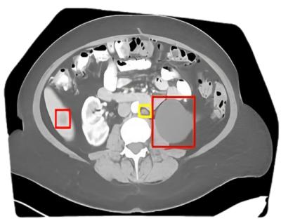 Lesion Detection