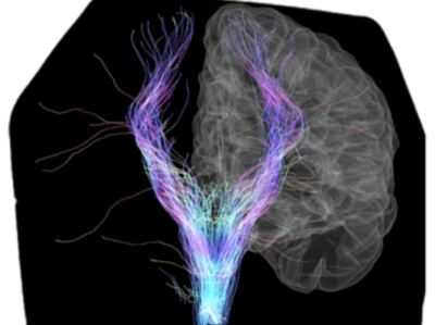 Healthcare NLP Datasets Healthcare NLP Datasets