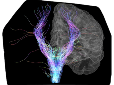 Neuroimaging Annotation