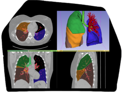 3D Medical Annotation