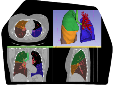 Anotación médica en 3D