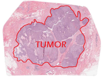 Pathological Annotation