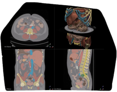 Anatomical Structure Annotation