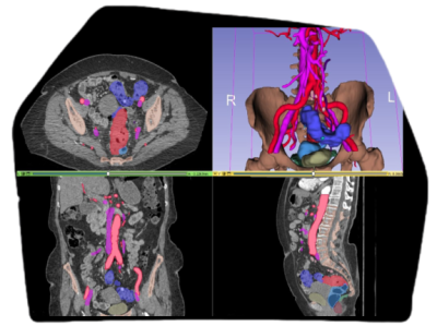 Vascular Annotation