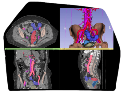 Anotación vascular