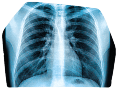 Radiological Imaging Datasets Radiological Imaging Datasets